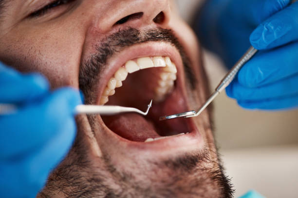 Emergency Dental Services in Caldwell, NJ